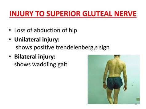 Isolated <strong>superior gluteal nerve</strong> injuries have been rarely described, 9 , 10 , 11 with a couple reports describing injection‐related injuries. . Superior gluteal nerve damage symptoms